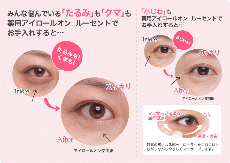 みんな悩んでいる「たるみ」も「クマ」も<strong>薬用アイロールオン ルーセント</strong>でお手入れすると…” /> </div>
<div class=