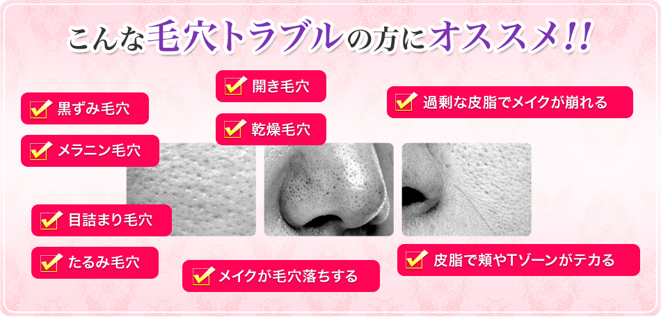 こんな毛穴トラブルの方にオススメ