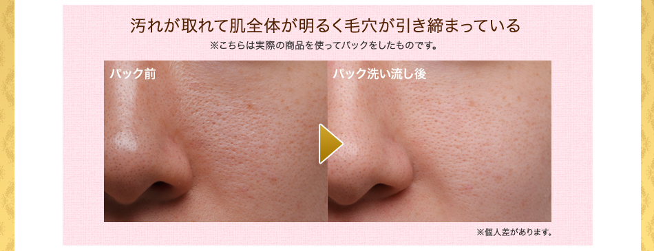 汚れが取れて肌全体が明るく毛穴が引き締まっている
