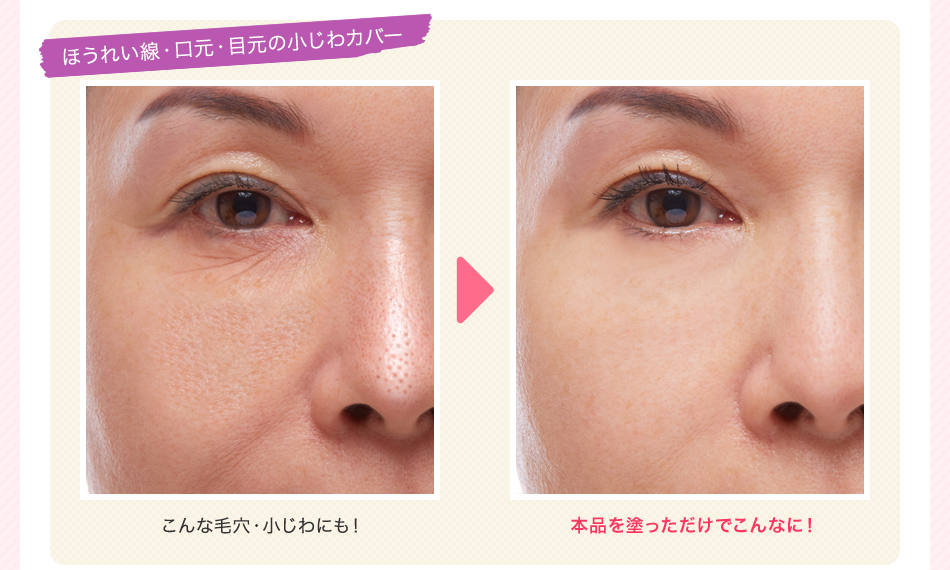 ほうれい線・口元・目元の小じわカバー