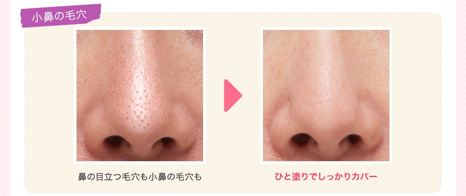 小鼻の毛穴