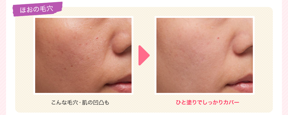 ほほの毛穴