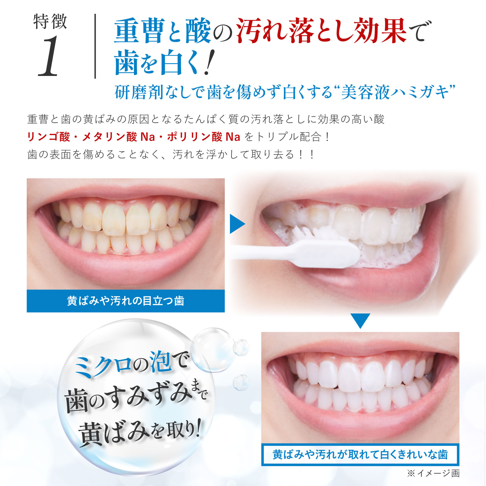 薬用ホワイトニング デンタワンAP