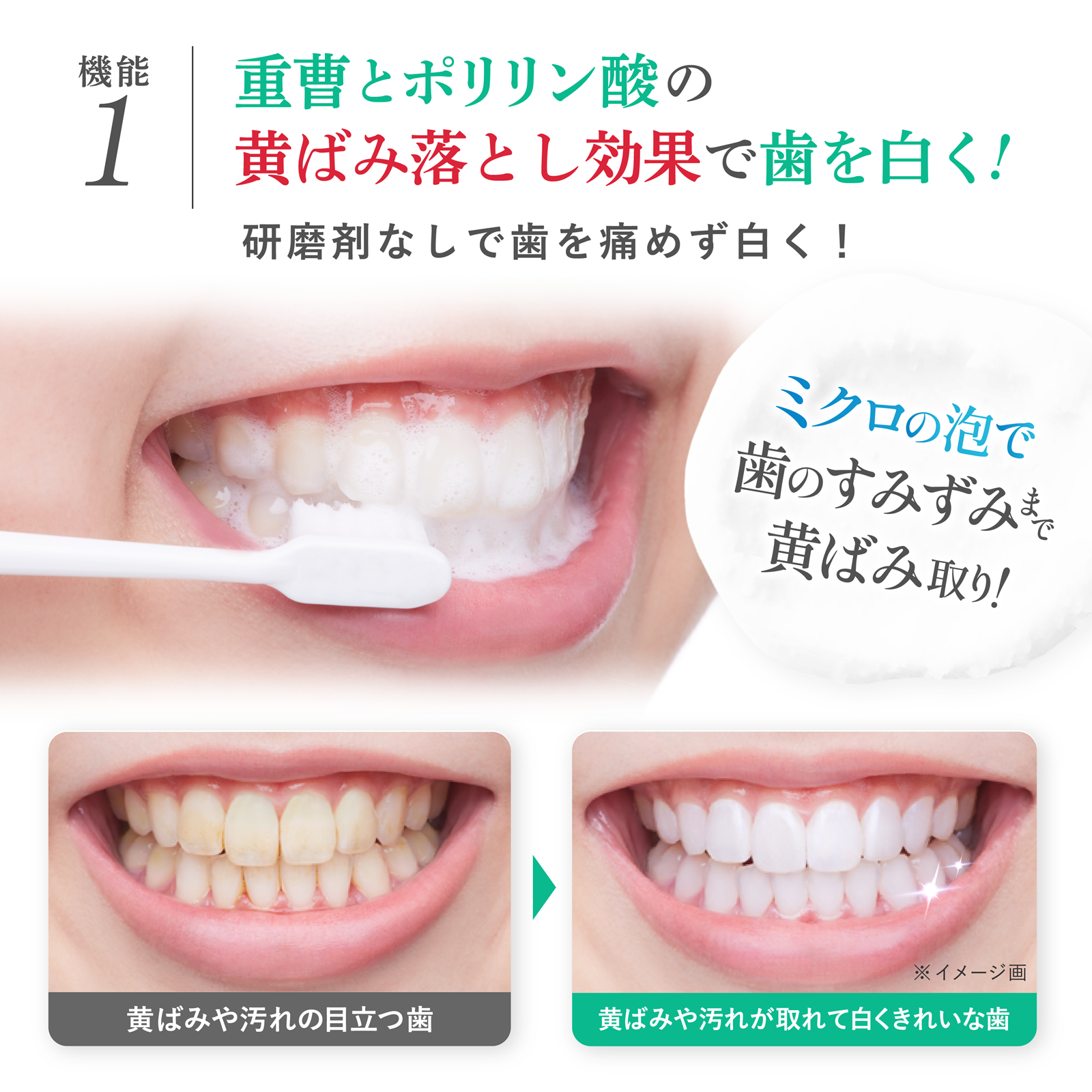 薬用ホワイトニング デンタワンAP