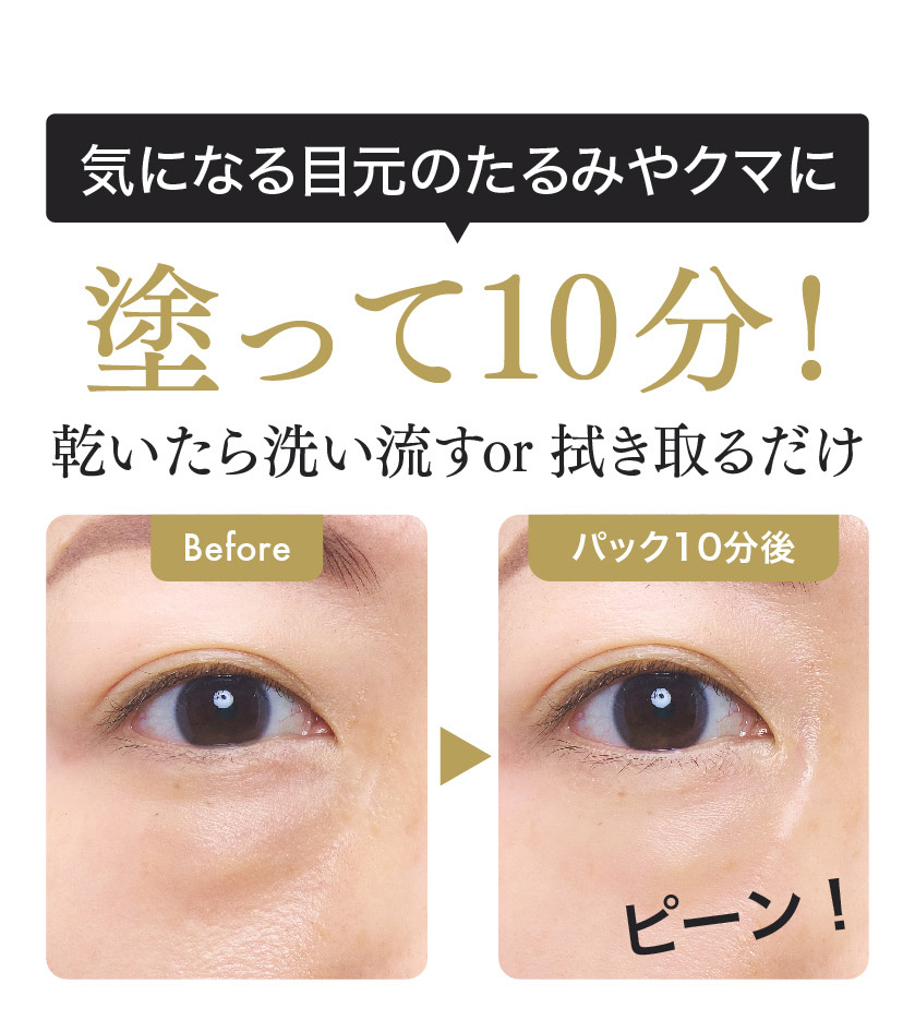 アイタイトセラム