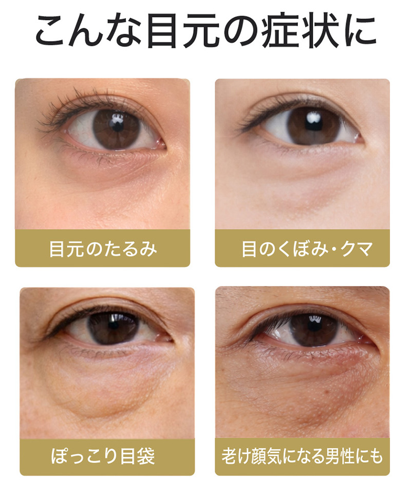 アイタイトセラム