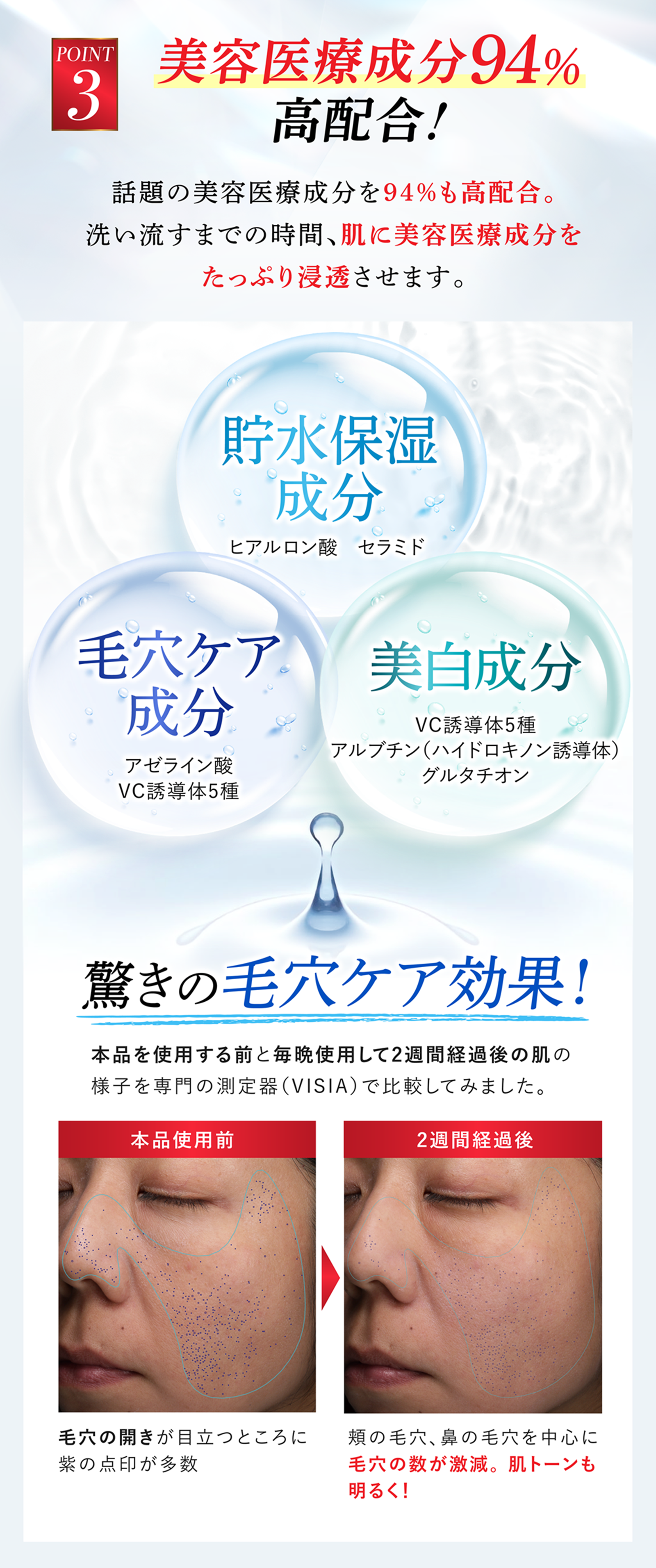 シミキールナイトバームー⑨