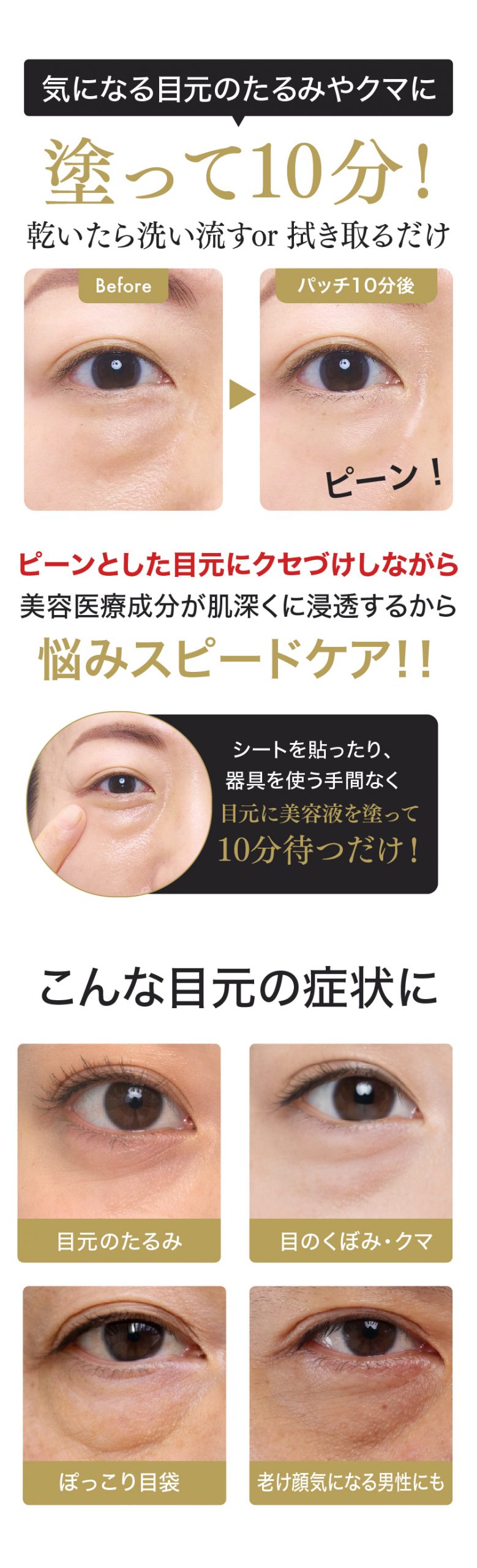 アイタイトセラム