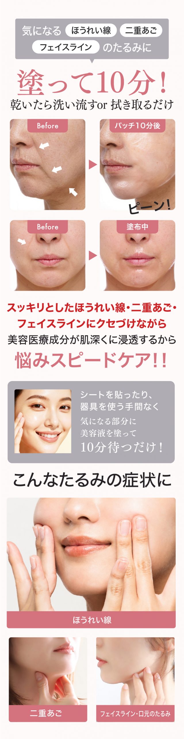 アンスキールタイトジェル