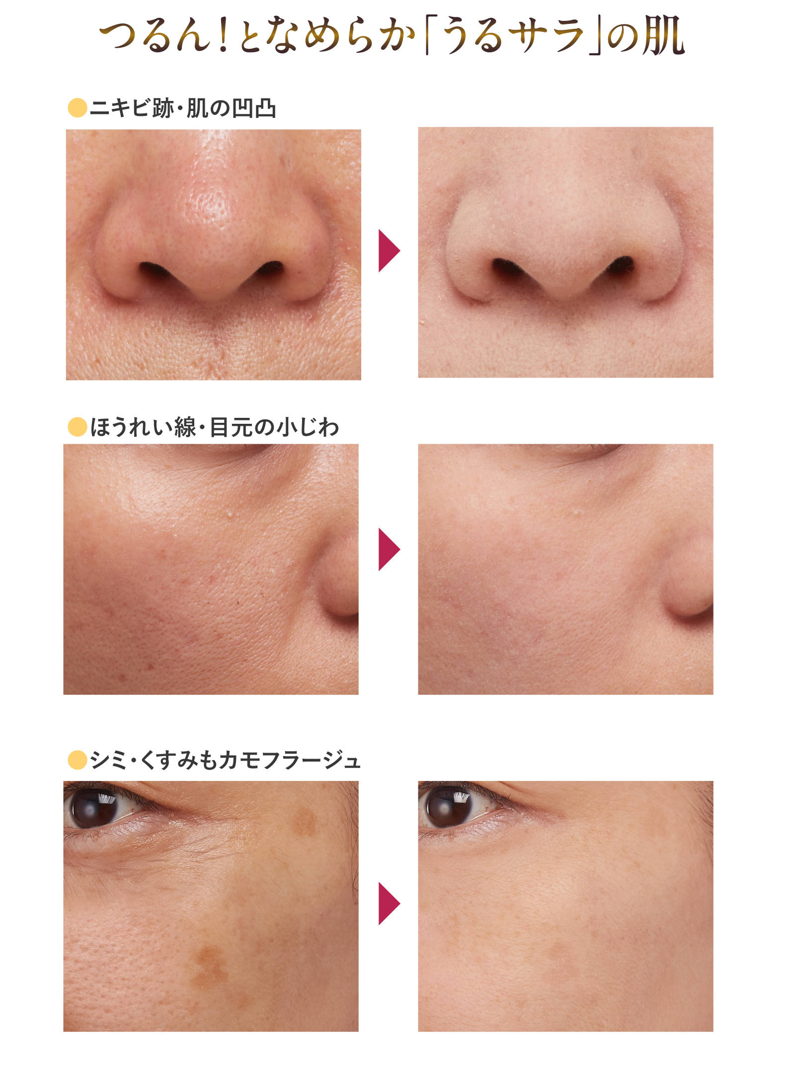 スキンプライマー