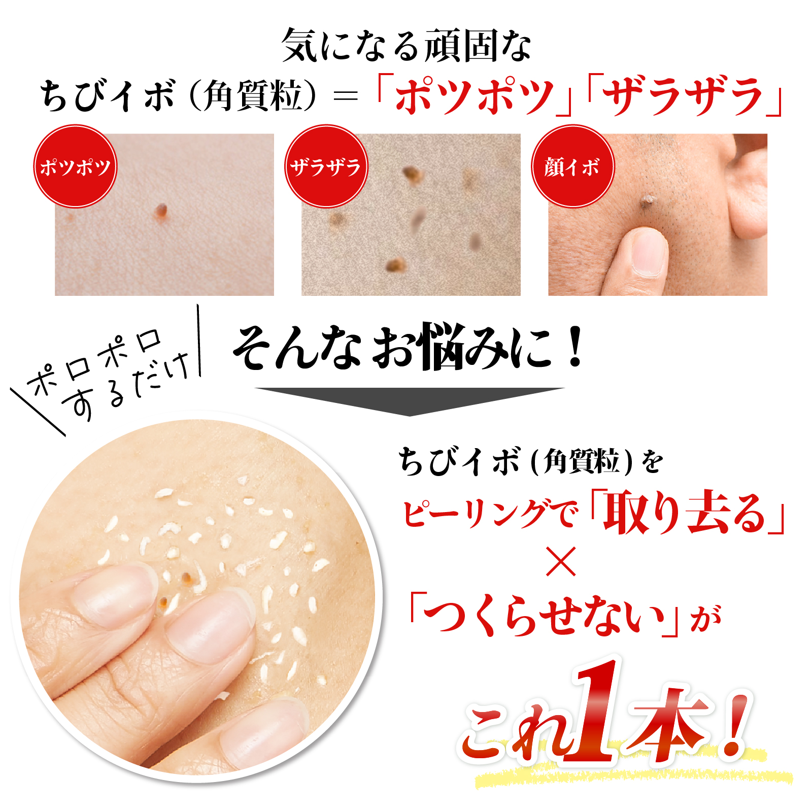 薬用ピーリングスムーサーEXW