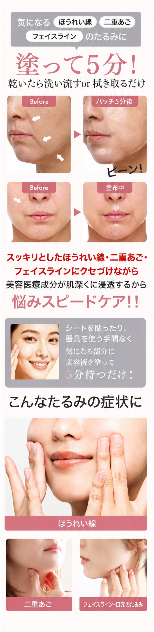 アンスキールタイトジェル