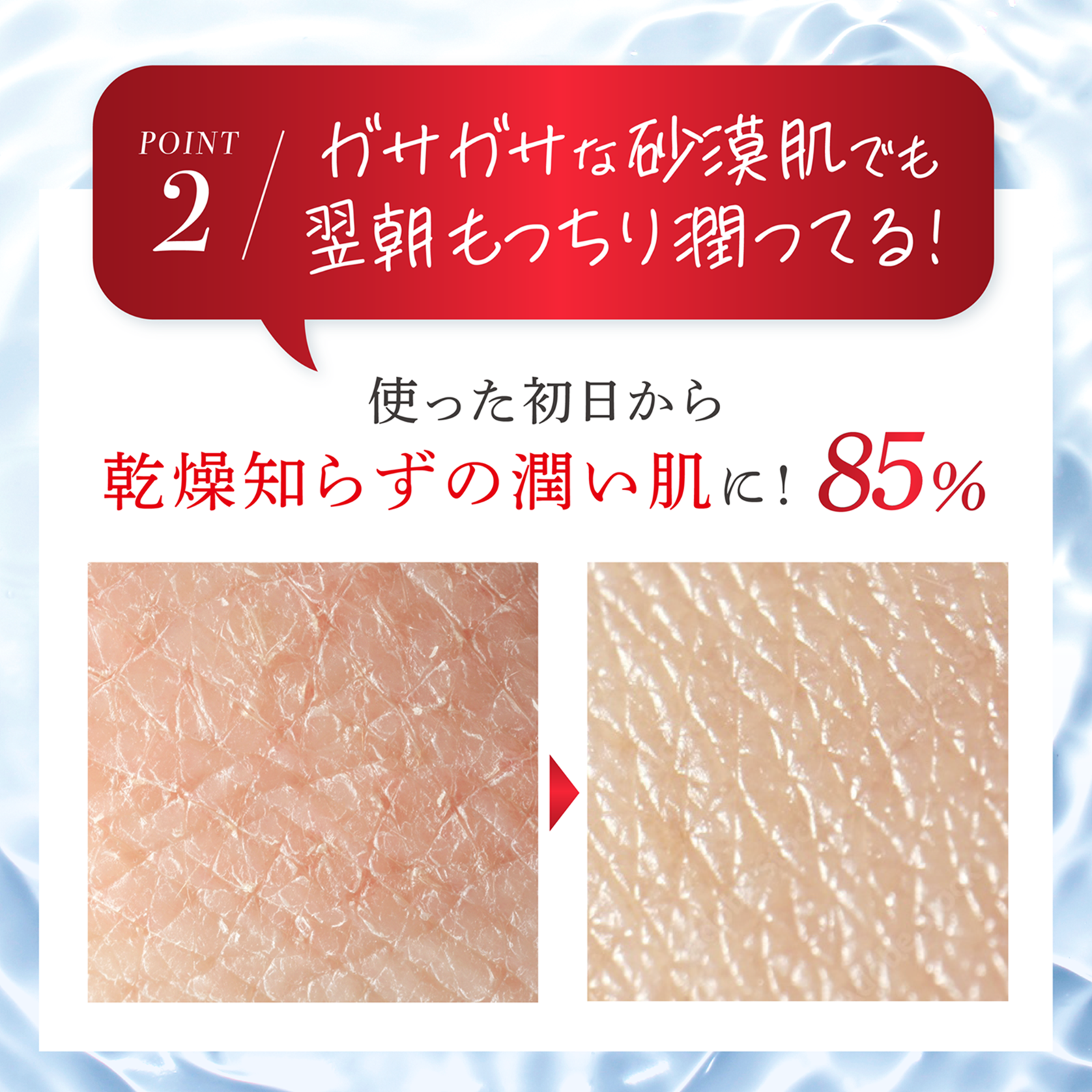 シミキールナイトバーム⑤