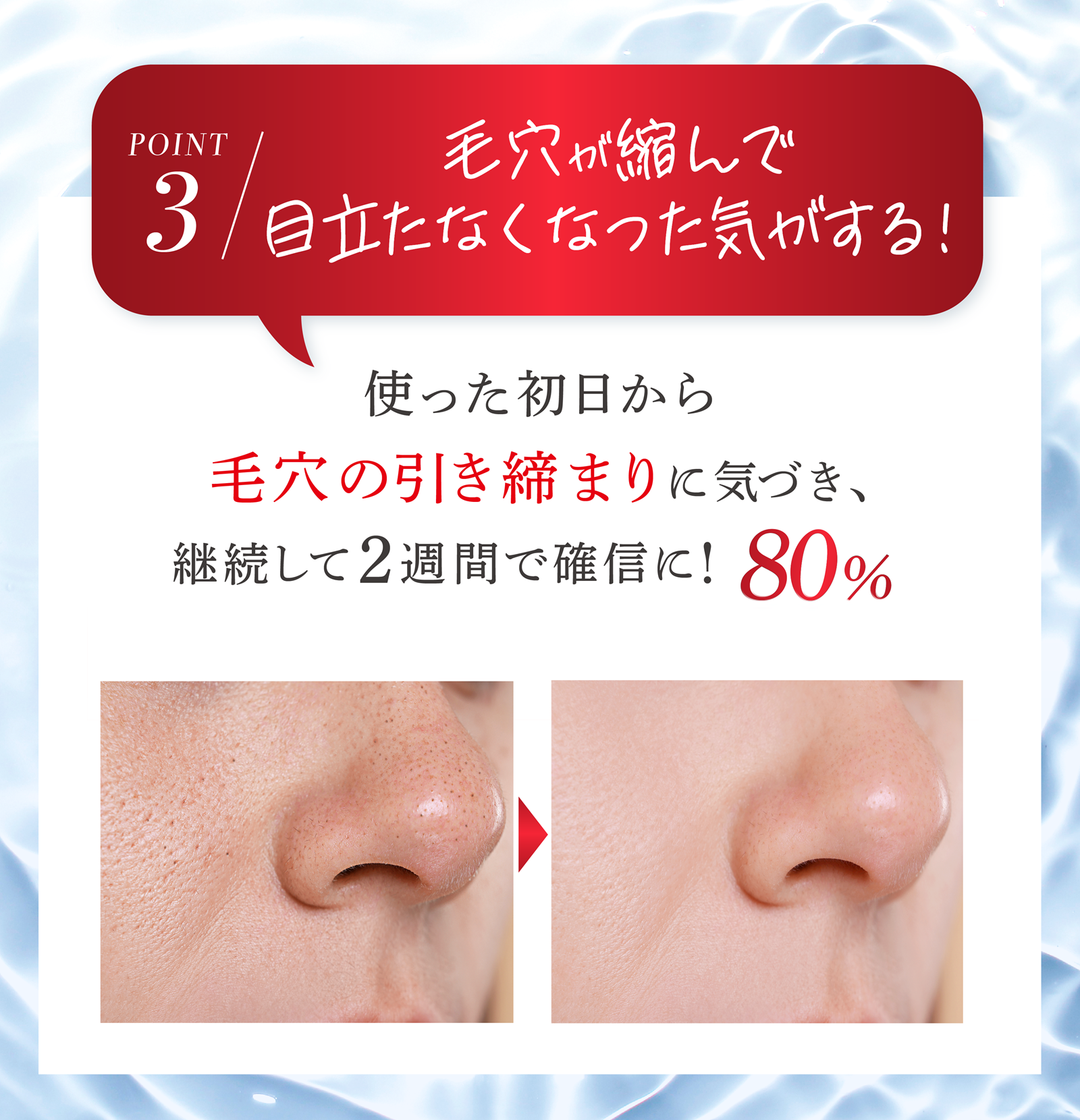 シミキールナイトバーム⑥