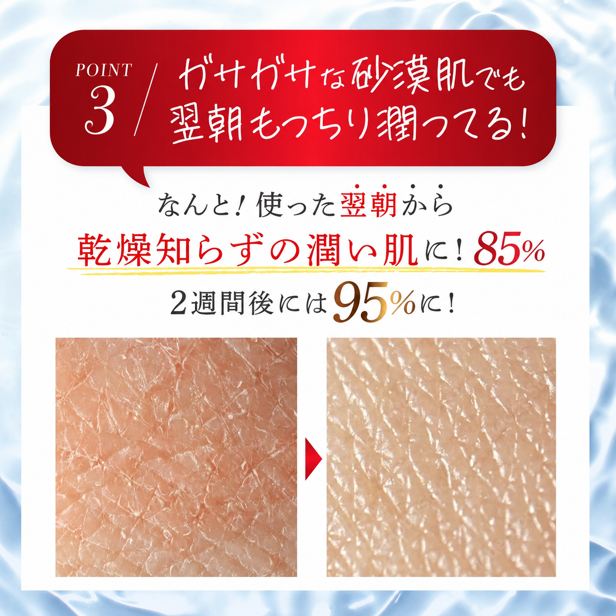 シミキールナイトバーム⑤