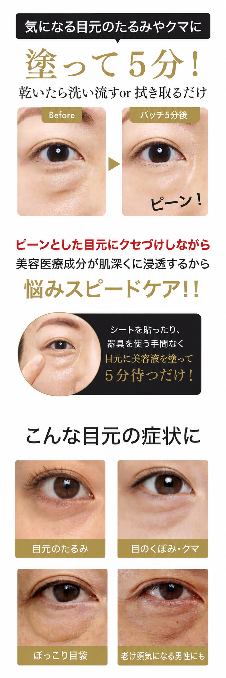 アイタイトセラム