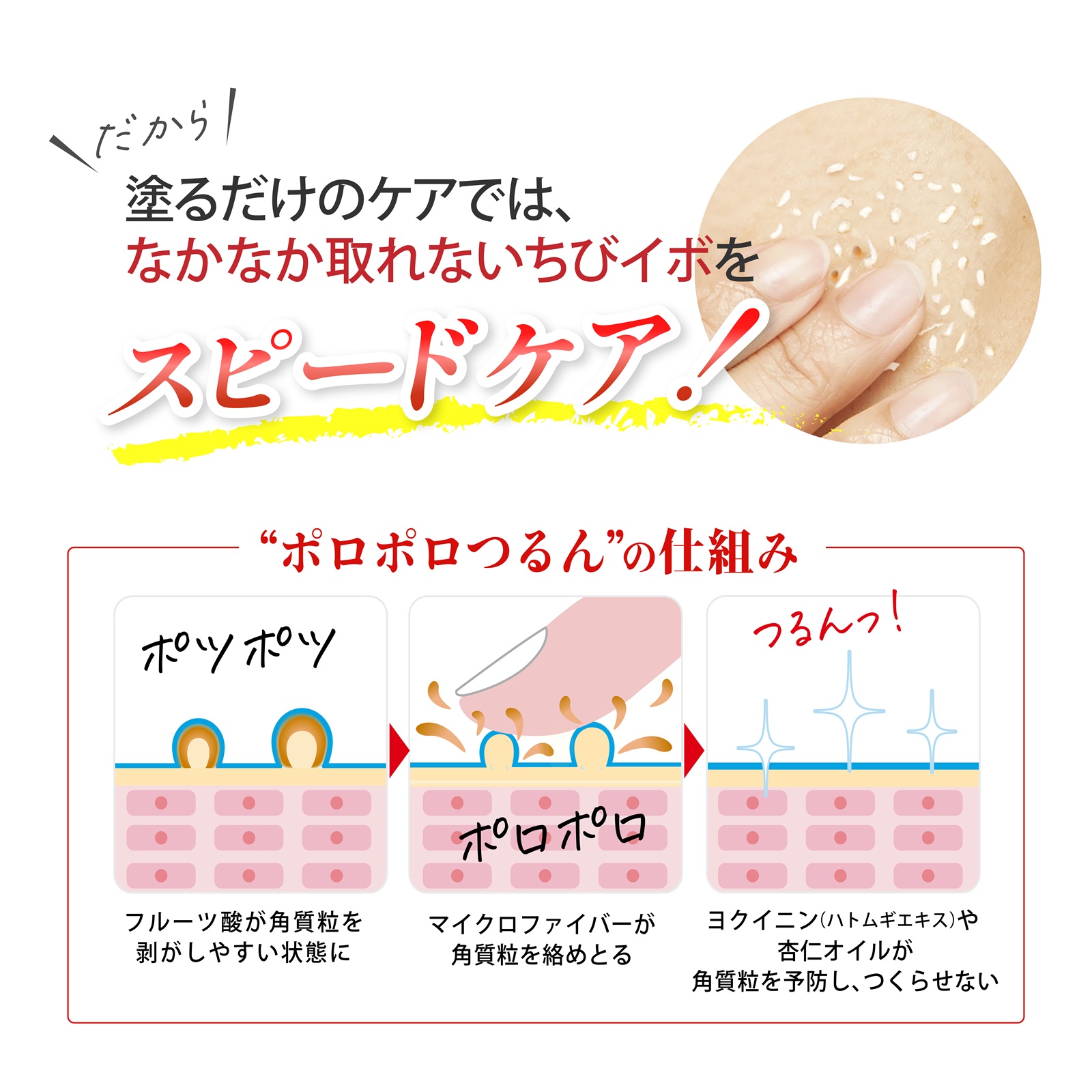 薬用ピーリングスムーサーEXW