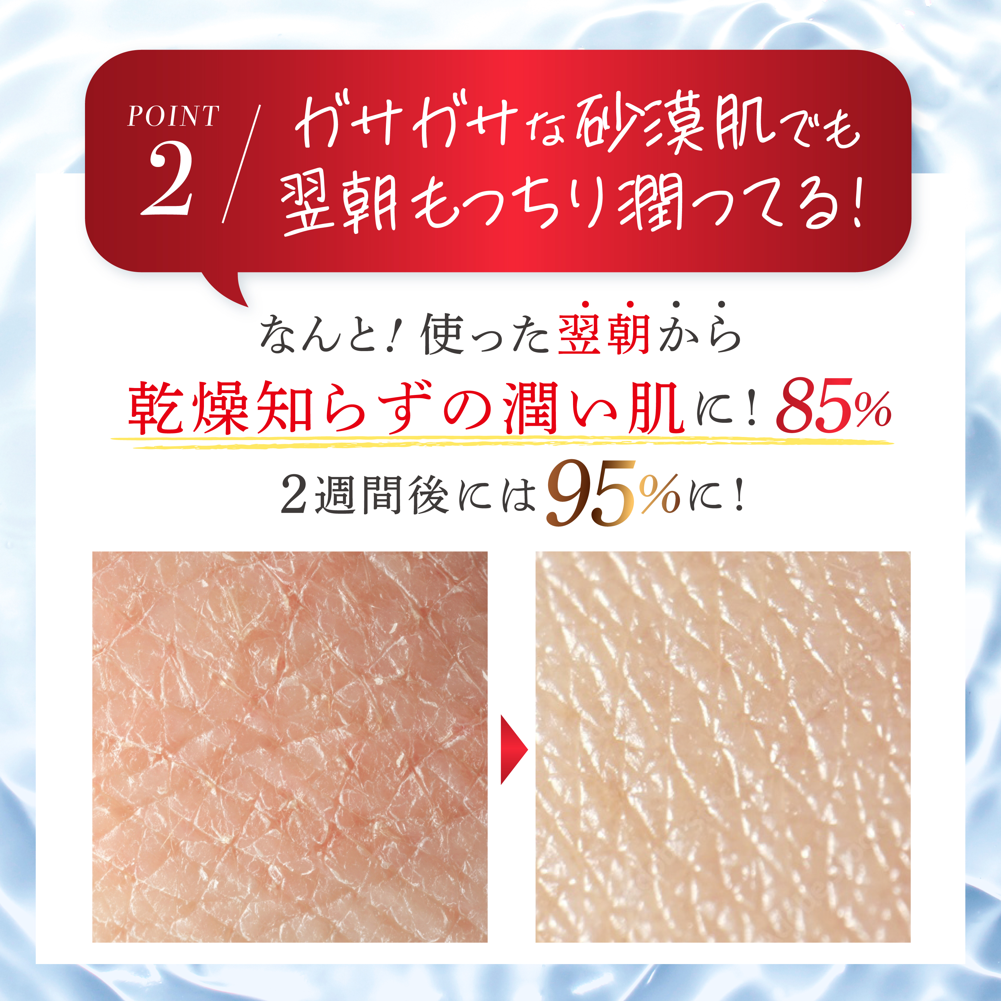 シミキールナイトバームー⑨