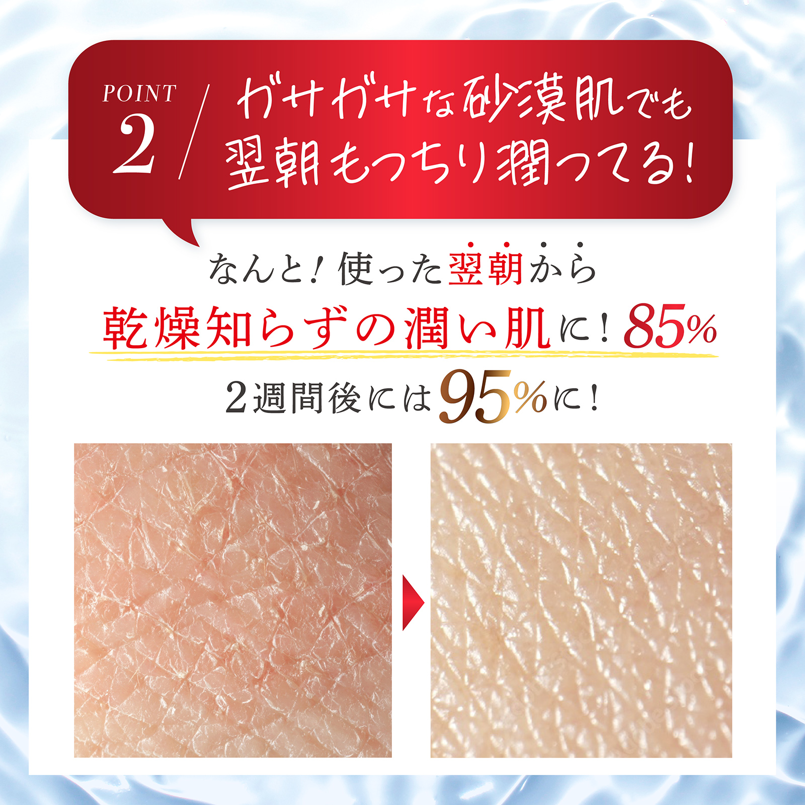 シミキールナイトバーム⑤